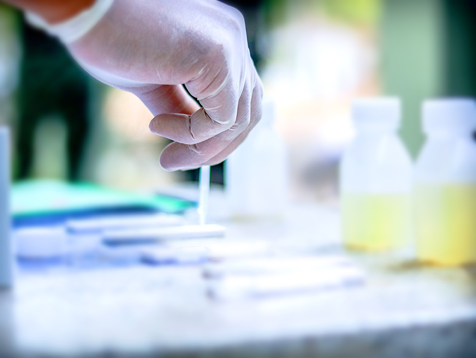 Omega-3 Index Testing